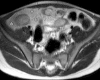 Figure 12b