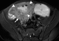 Figure 19b