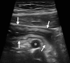 Figure 3a