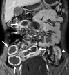 Figure 4b