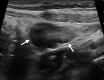 Figure 14a