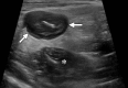 Figure 5a