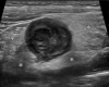 Figure 12a
