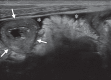 Figure 11a