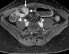 Figure 15b