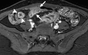 Figure 18b