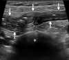 Figure 4a
