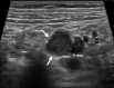 Figure 13a