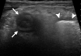 Figure 19a