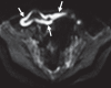 Figure 7b