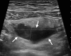 Figure 20a