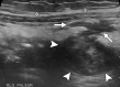 Figure 18a
