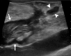 Figure 15d