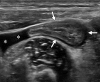 Figure 17a