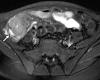 Figure 16b