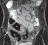 Figure 9c