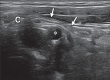 Figure 1a