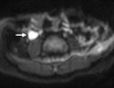 Figure 14b