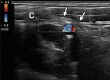 Figure 1b