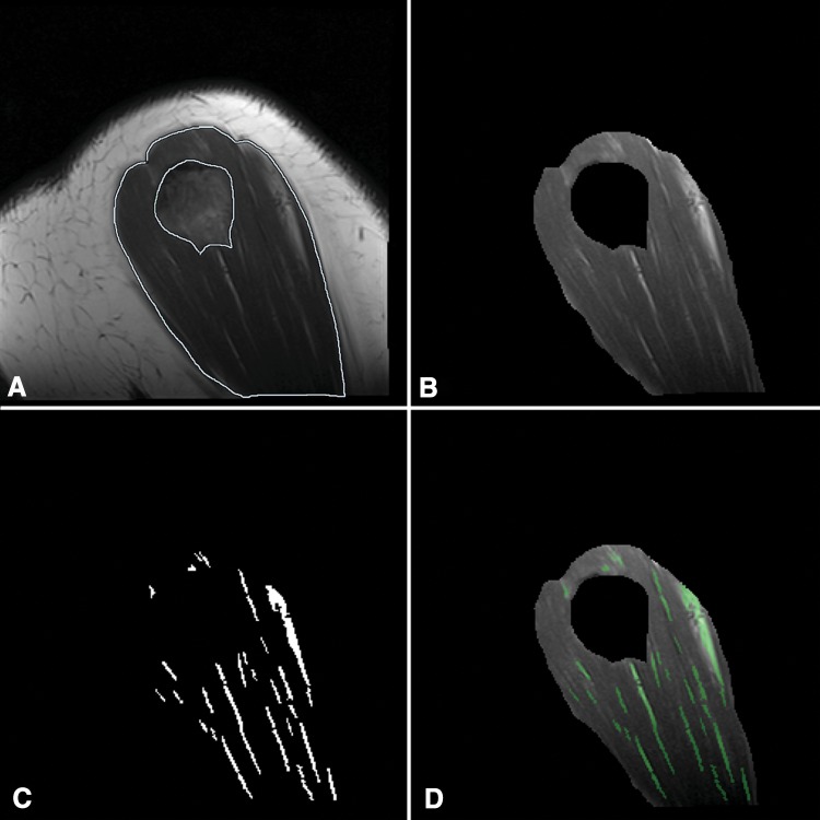 Fig. 1A–D