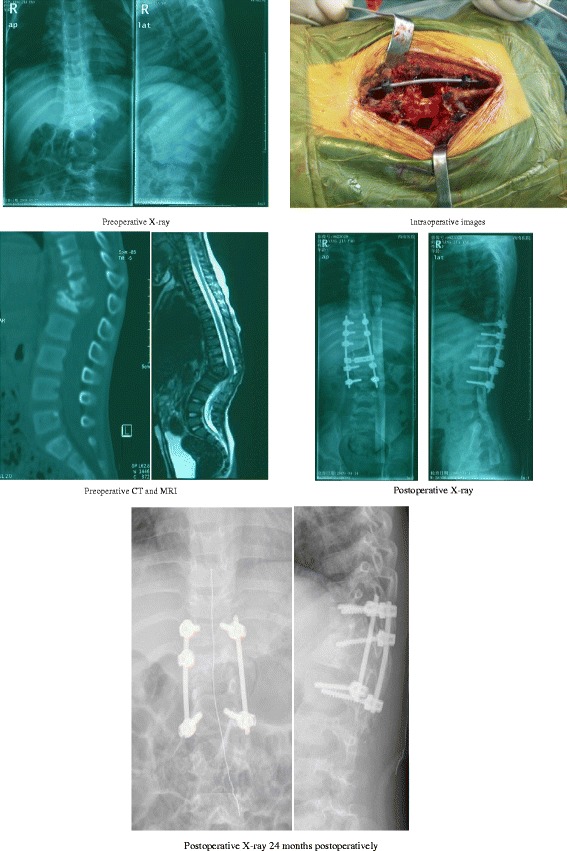 Fig 2