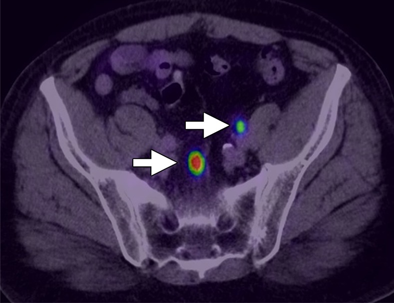 Figure 9b: