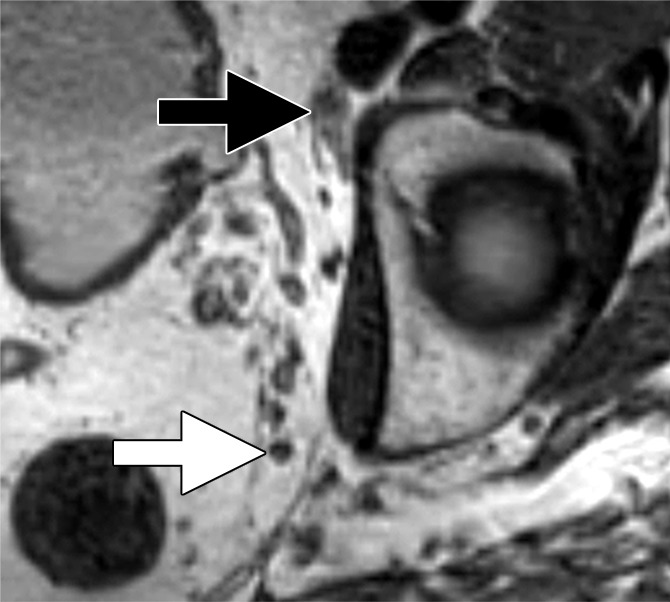 Figure 4d: