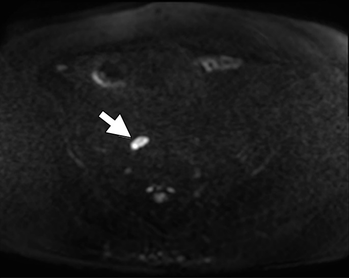 Figure 5b: