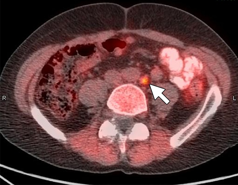 Figure 7b: