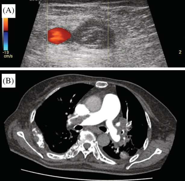 FIGURE 1