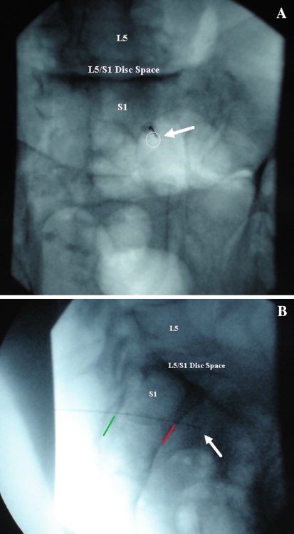 Fig. 3