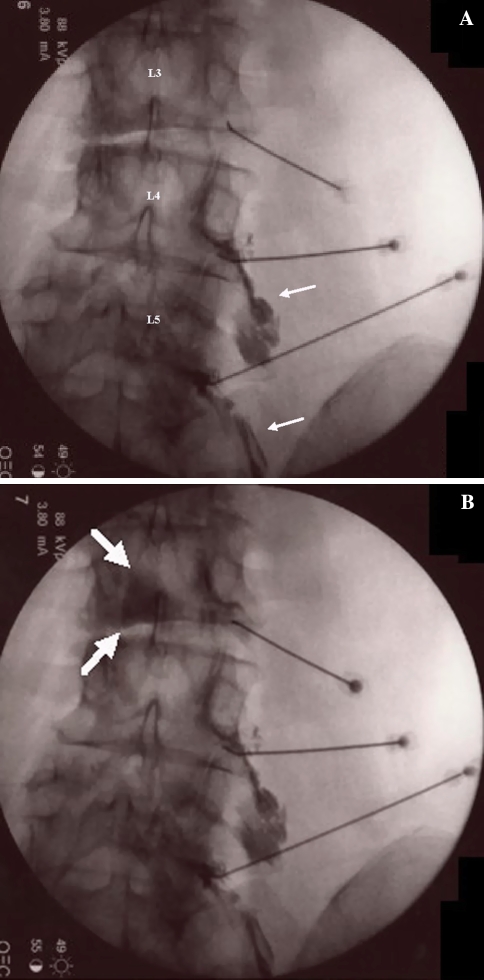 Fig. 6