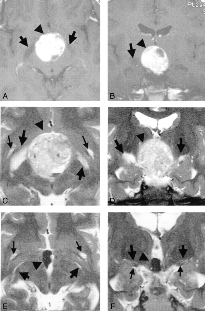 Fig 3.