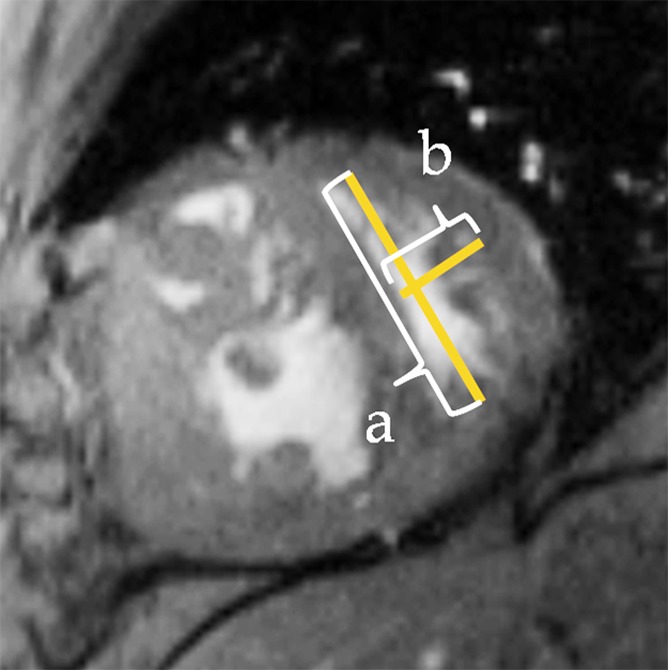 Figure 1d: