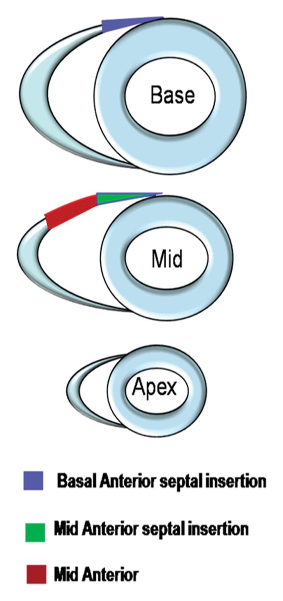 Figure 3b: