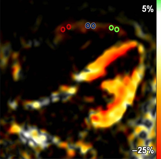 Figure 1b: