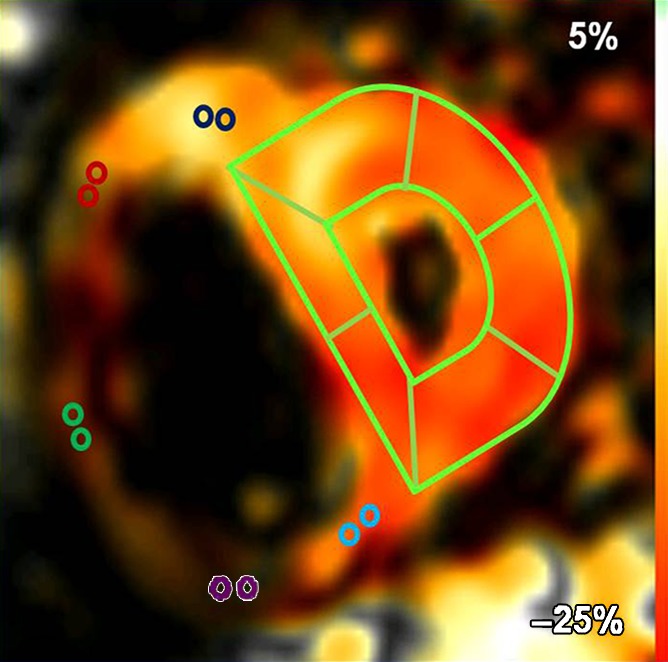 Figure 1a: