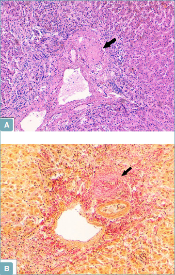 Figure 14.