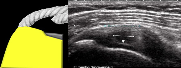 Figure 11