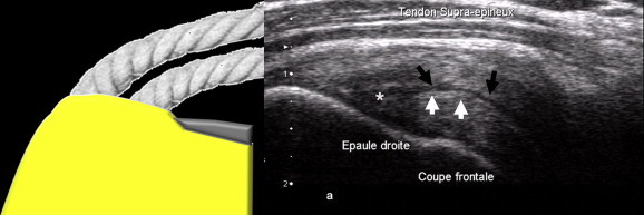 Figure 14