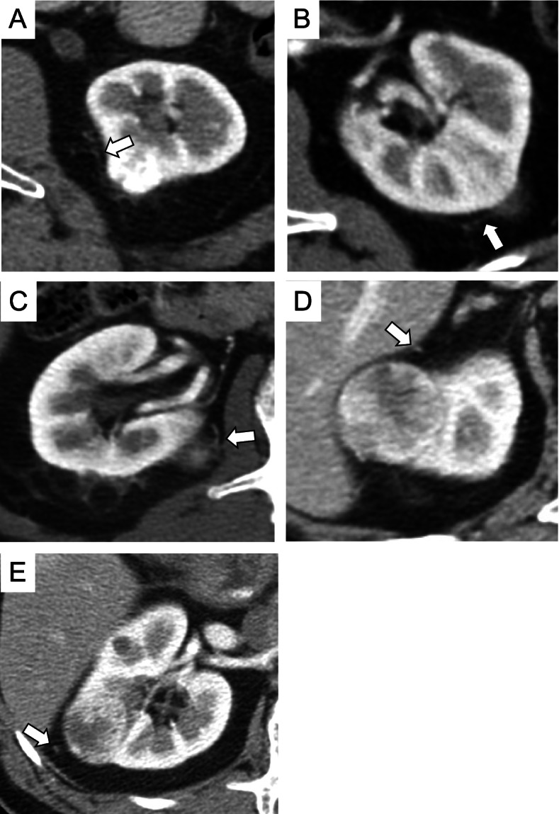 Fig. 4