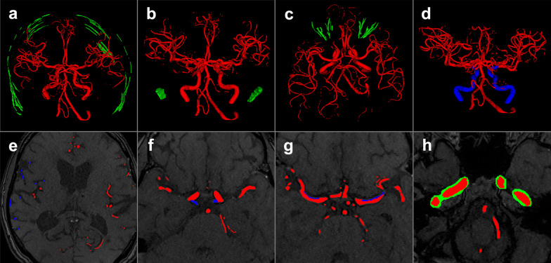 Fig. 2