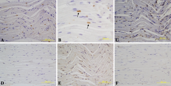 Fig. 1A–F