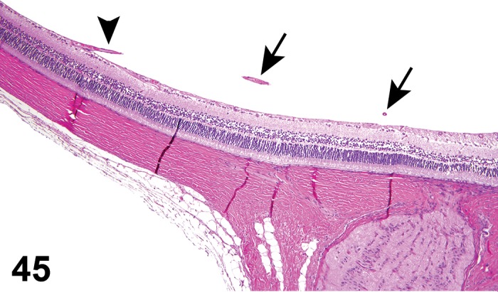 Figure 45.