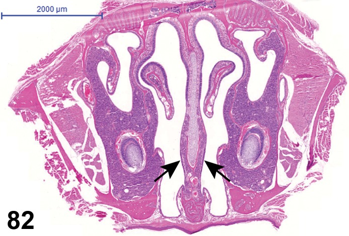 Figure 82.