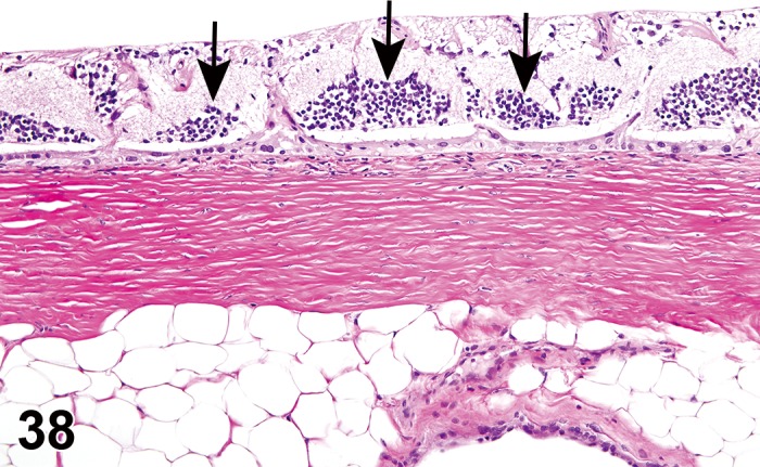 Figure 38.