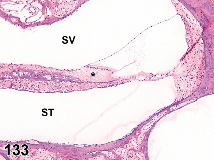 Figure 133.