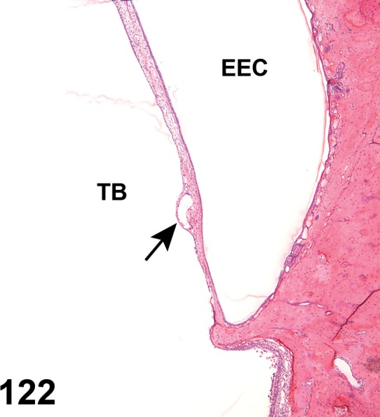 Figure 122.