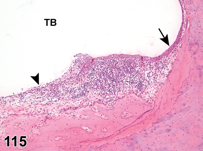 Figure 115.