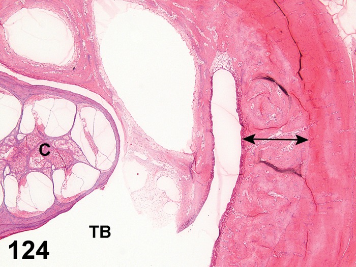 Figure 124.